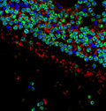 Linea 3. Studio e modulazione della risposta immunitaria innata e adattativa